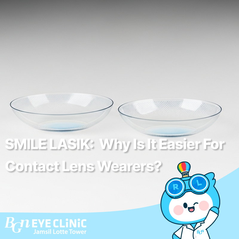 SMILE Lasik: Why Is It Easier for Contact Lens Wearers?
